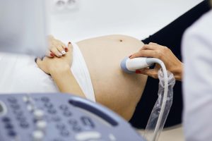 z wyjątkiem patologii. specjalista badający ciężarną dziewczynę. zdjęcie z bliska. nagi brzuch z aparatem USG