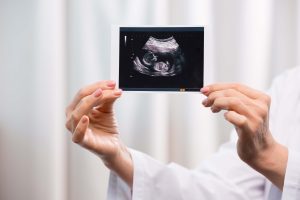 częściowy widok lekarza trzymającego skan dziecka w rękach